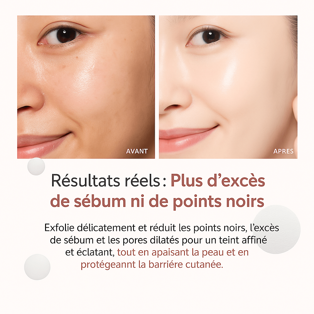 Tampons zéro pores KYIA Beauté - fabriqué en Corée korean beauty
