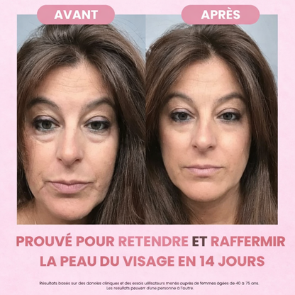 Brosse lymphatique KYIA