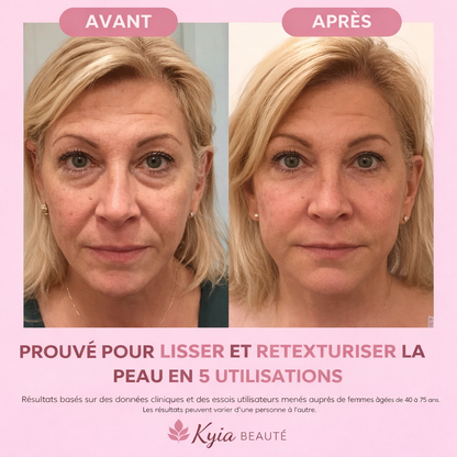 Brosse lymphatique KYIA