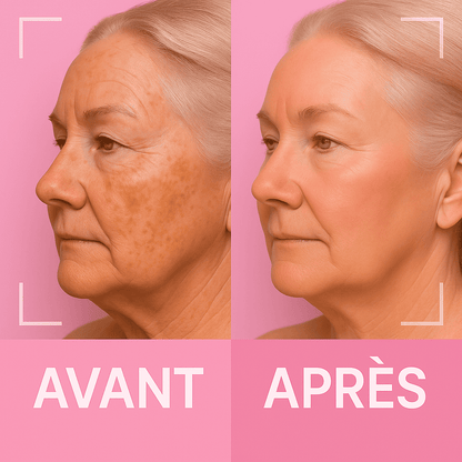 Masque LED de Luminothérapie 7-en-1 - KYIA® LED