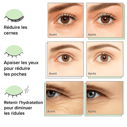 Patchs pour les yeux au collagène Kyia pour les cernes et les poches - Kyia - Beaute