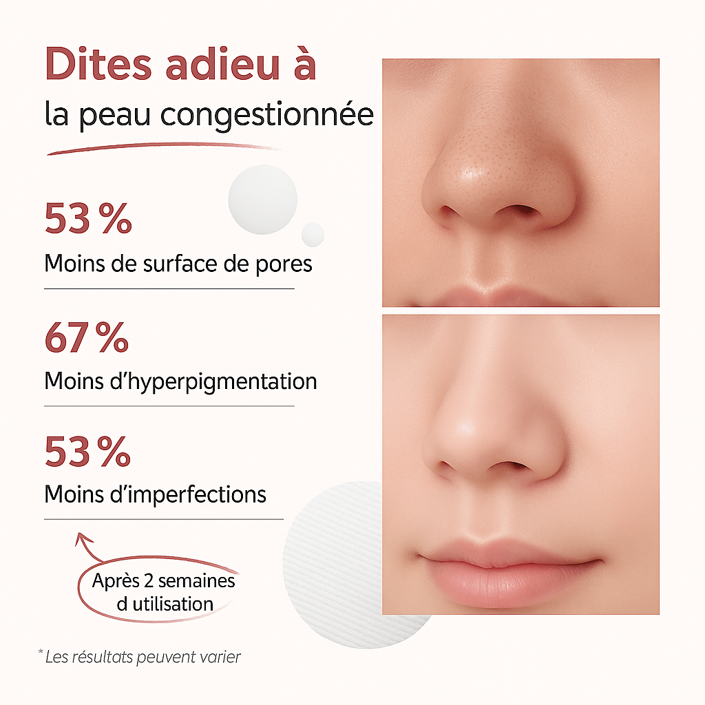 Tampons zéro pores - Kyia - Beaute