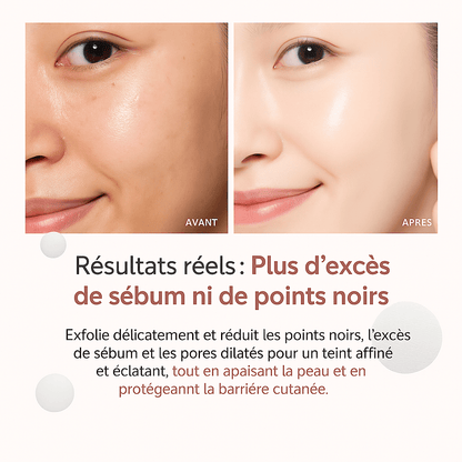 Tampons zéro pores - Kyia - Beaute